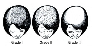 Ludwig Scale