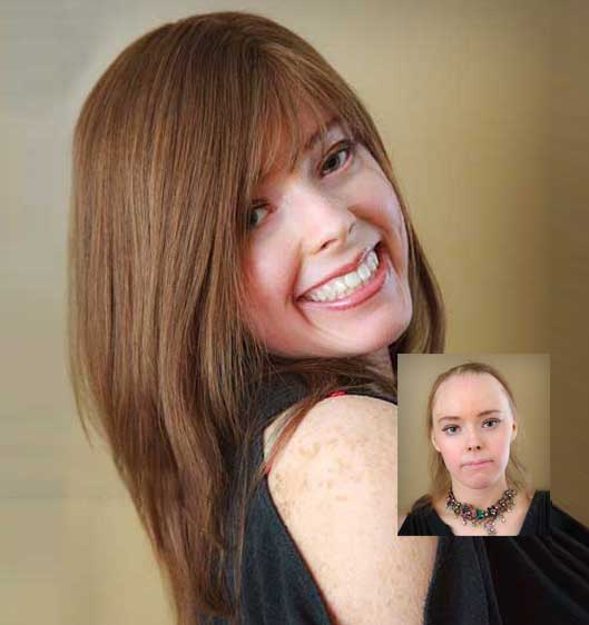 Wigs for cancer patients huntsville al discount