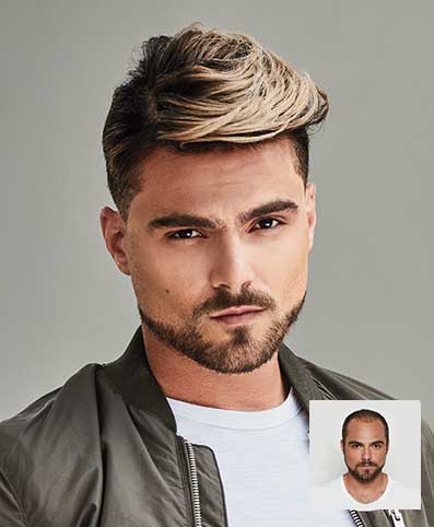 mens hair patch hair replacement huntsville alabama