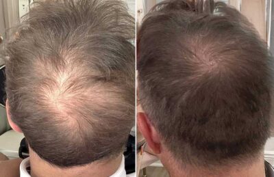 before after treatment